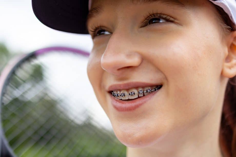 How Long Does Orthodontic Treatment Take? Timeline by Case Type