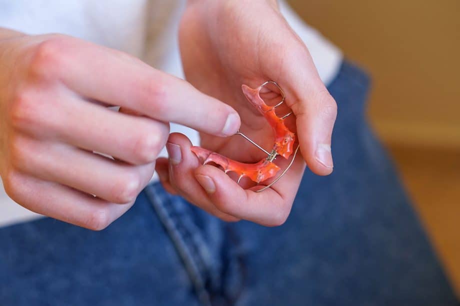 How to Eat with a Palate Expander
