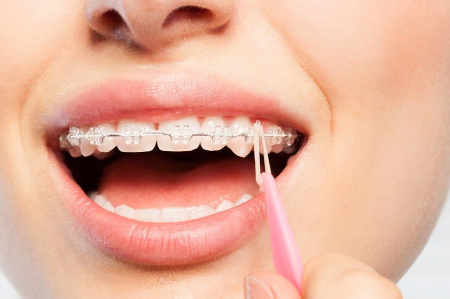 Orthodontist Visit Frequency During Treatment | Hass