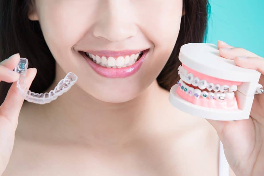 When Do You Start Wearing Rubber Bands For Braces?